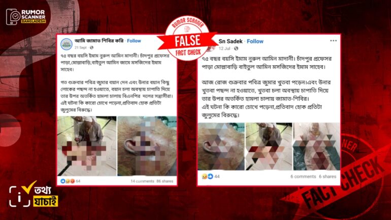 চাঁদপুরে খতিবকে কুপিয়ে আহতের ঘটনা অভিযুক্ত ব্যক্তি কোনো রাজনৈতিক দলের নেতা নন 